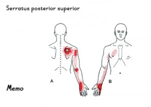 tp-Serratus-posterior-super